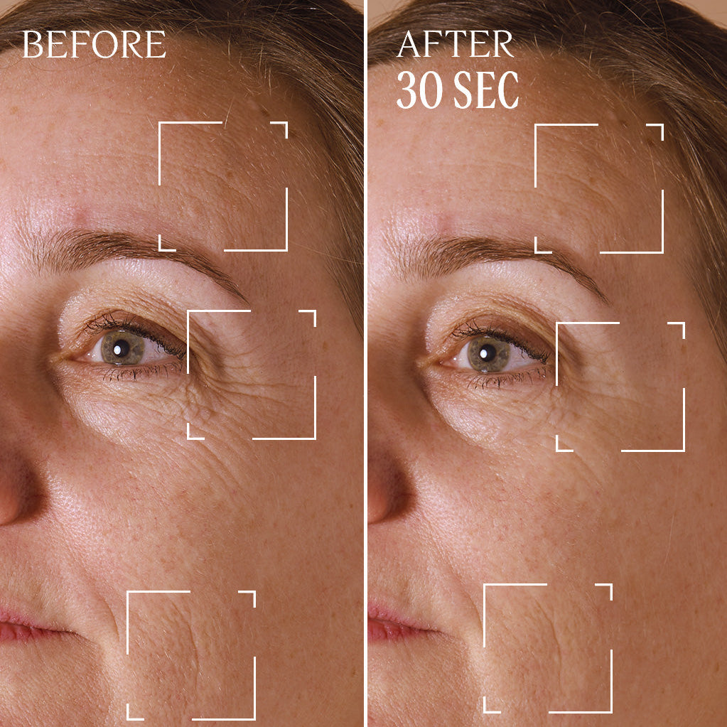 Immortelle Divine Targeted Wrinkle Care